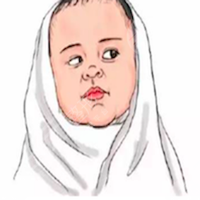貴陽美貝爾整形口碑如何？誠意分享B****術(shù)后對(duì)比