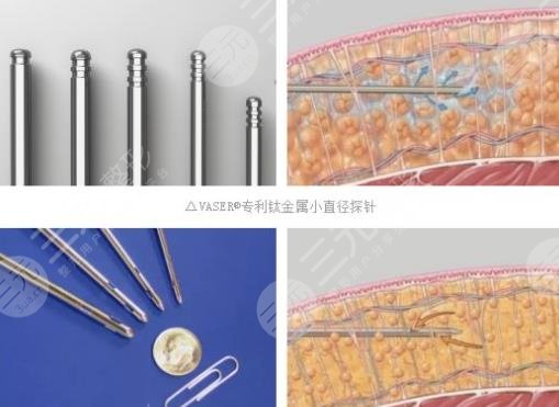 威塑抽脂