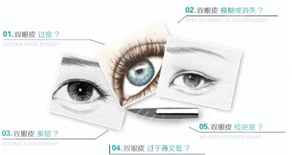 眼修復(fù)