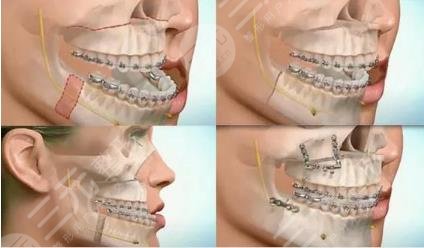 廣州廣大醫(yī)院擅長項(xiàng)目介紹科普