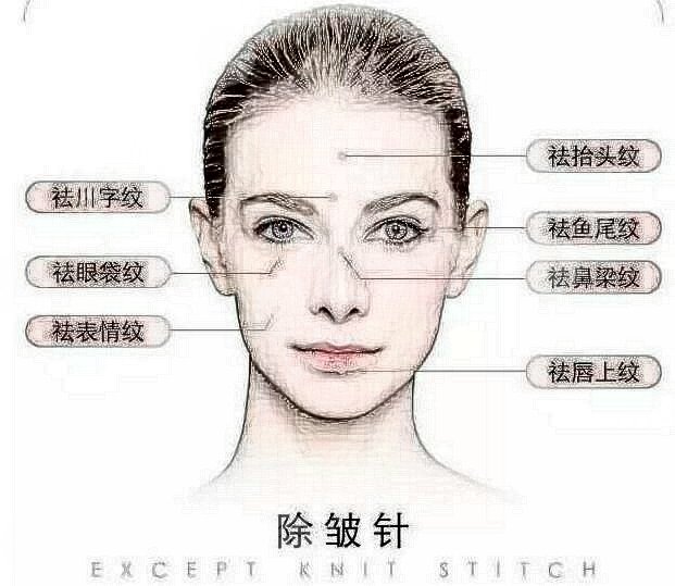 上海伯思立醫(yī)療美容除皺手術案例