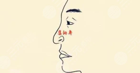 鷹鉤鼻