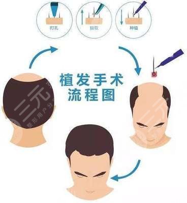 山西大同有沒有植發(fā)醫(yī)院