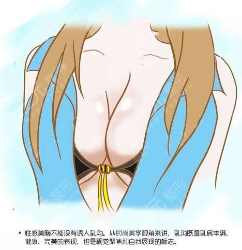 康寧假體和曼托假體哪個(gè)好？哪個(gè)手感好？康寧假體是國(guó)產(chǎn)還是進(jìn)口？