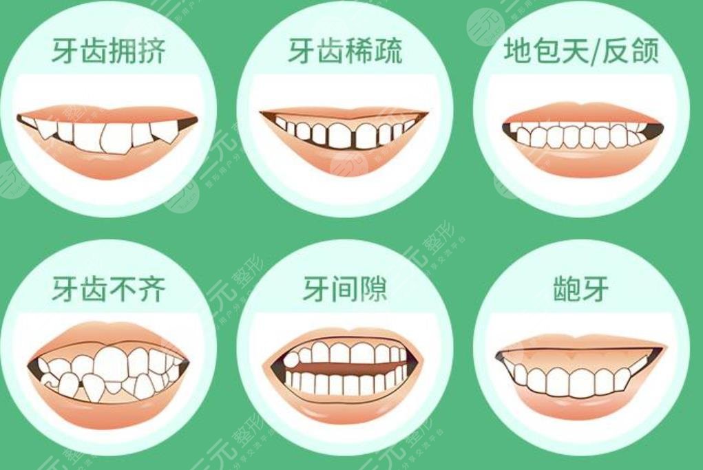 牙齒矯正