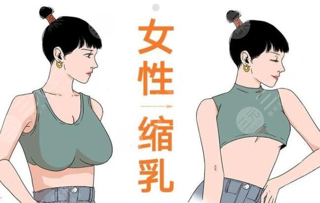 棒棒糖縮胸手術(shù)多少天完全消腫？