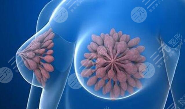 康寧假體和德美分別是？哪個(gè)假體美胸程度更好？專業(yè)人士教你選！