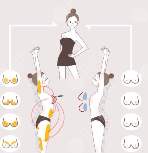 康寧假體優(yōu)勢(shì)是什么?