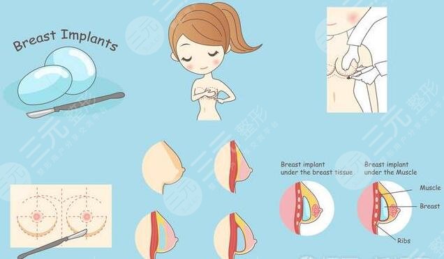 德美假體優(yōu)勢(shì)是什么?