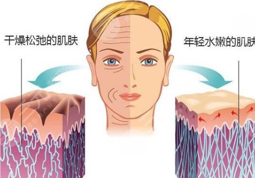 光子嫩膚祛斑果怎么樣？多少錢？價格表+禁忌人群+術(shù)后護理盤點！
