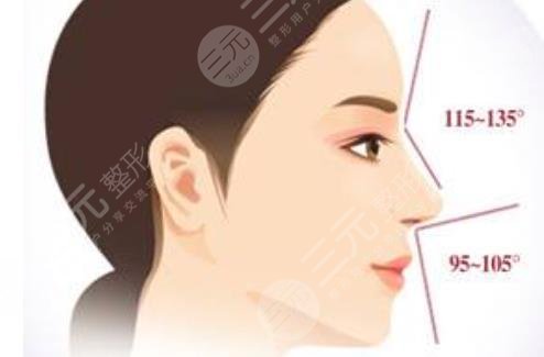 歪鼻矯正