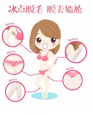 九江中醫(yī)醫(yī)院整形科科普脫毛激光原理