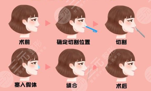 北京圣嘉榮醫(yī)療美容醫(yī)院熱門(mén)項(xiàng)目科普