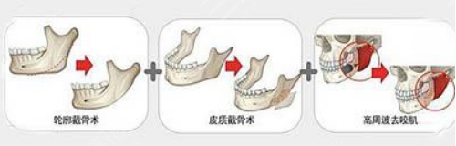 北京圣嘉榮黃大勇醫(yī)生擅長項目