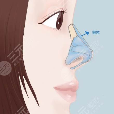 北京圣嘉榮黃大勇醫(yī)生擅長項目