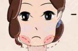 下頜角