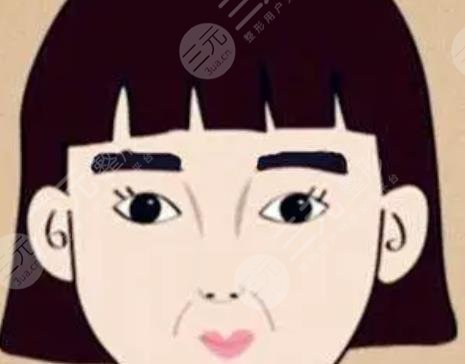 眉毛種植