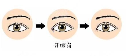 選擇醫(yī)生技術(shù)不過關(guān)