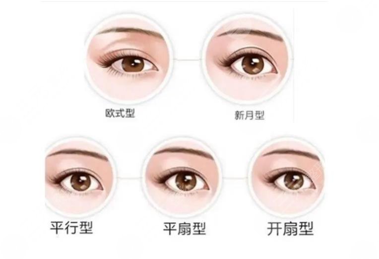 割雙眼皮十個(gè)有九個(gè)后悔真的嗎？3點(diǎn)術(shù)前了解事宜盤點(diǎn)！