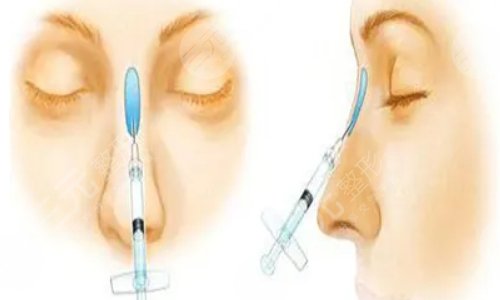 上海第九人民醫(yī)院整形專家排名