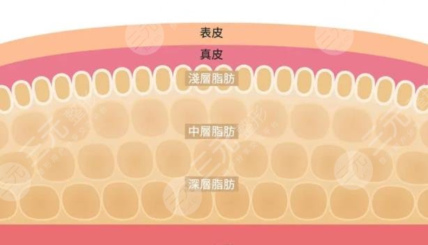 脂肪體雕