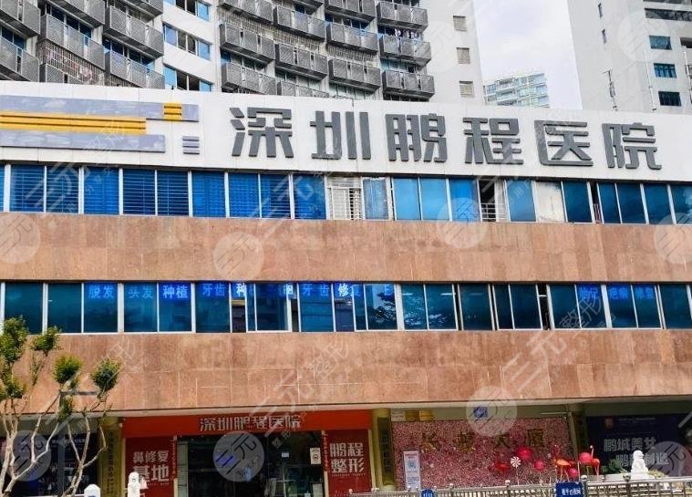 深圳植發(fā)?？漆t(yī)院