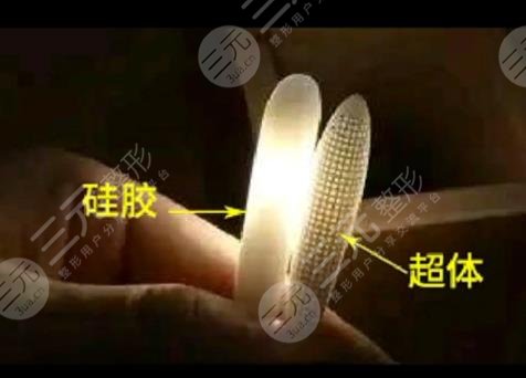 超體鼻假體