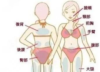 手臂吸脂
