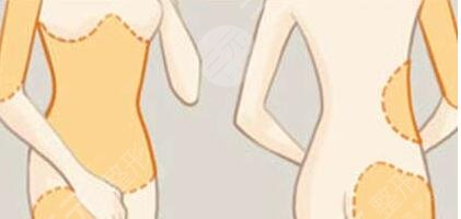 手臂吸脂