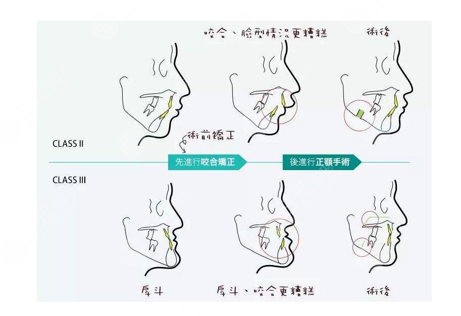 北醫(yī)三院口腔科特色緩解項(xiàng)目、口腔牙齒畸形矯正