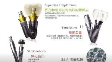 牙齒種植：