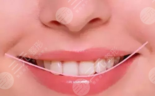 牙齒美容