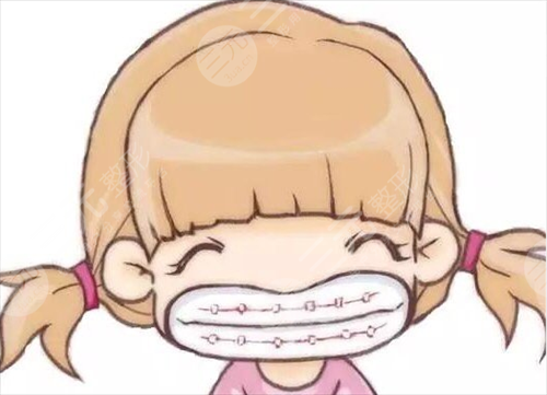 矯正期間