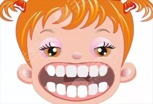 影響自鎖托槽價(jià)格因素