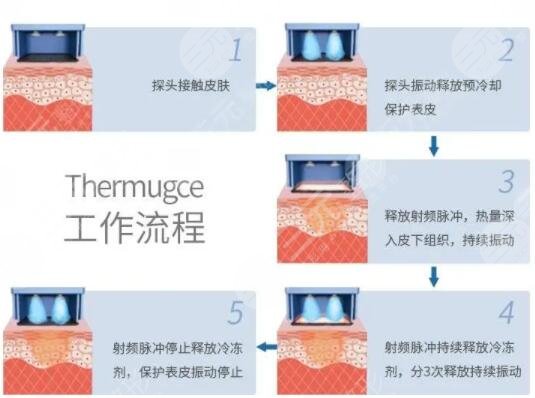 賽諾秀5D果可以維持多久？