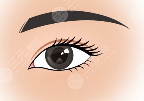 激光手術(shù)有哪些注意事項(xiàng)?