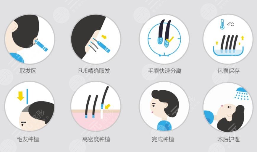 長沙新茂醫(yī)學植發(fā)手術(shù)過程體驗案例分享