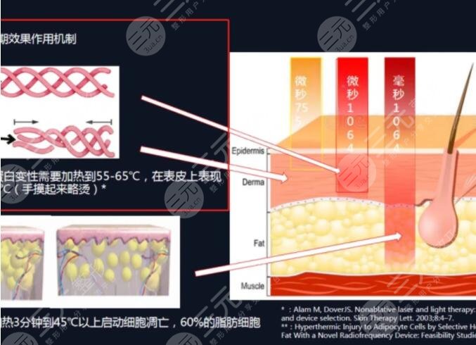 賽諾秀5d膠原光的術(shù)前注意事項(xiàng)