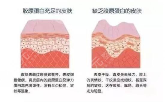 膠原蛋白豐蘋果肌果好不好