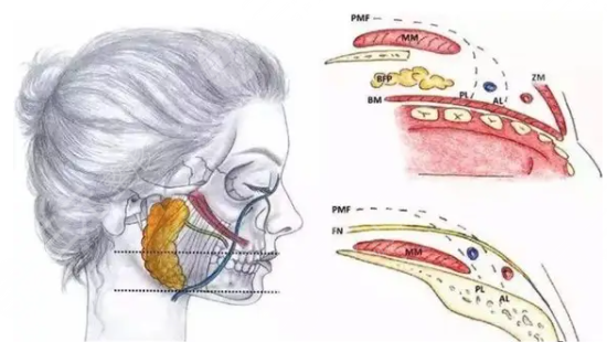 取頰脂墊對比圖