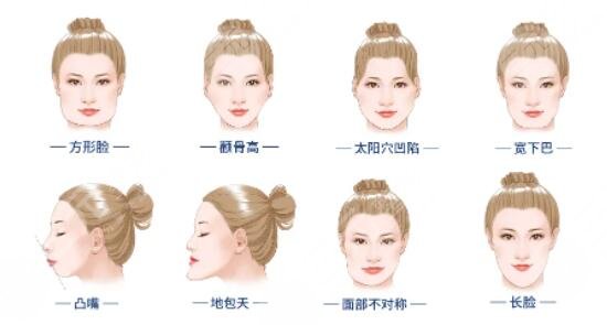 瓜子臉手術(shù)
