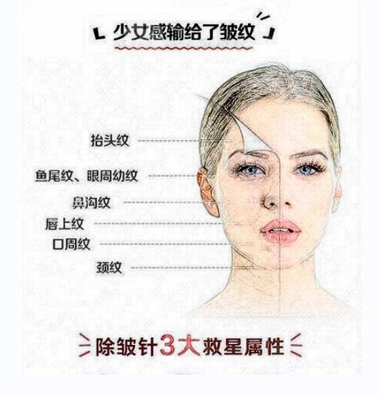 眼部皺紋