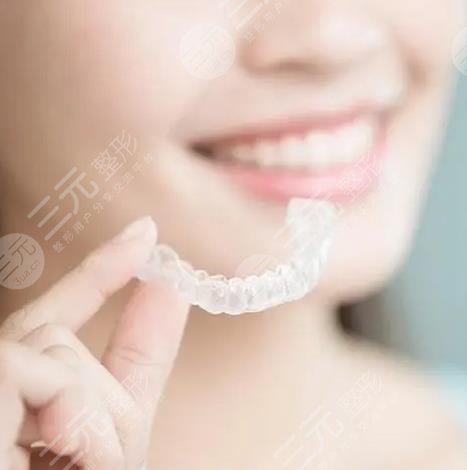 上海十院牙齒矯正案例
