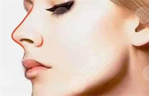 鼻翼缺損矯正手術(shù)會留疤嗎?