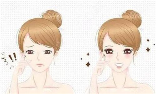 眼皮松弛