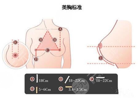 副乳手術(shù)果圖