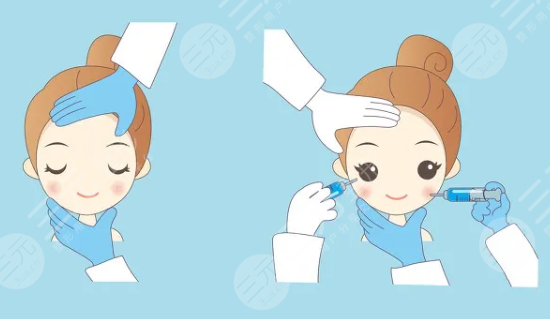 打玻尿酸注意事項