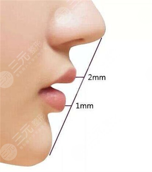 鼻翼鼻尖整形手術(shù)的果好不好