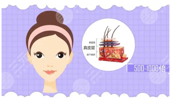 玻尿酸填淚溝經(jīng)驗(yàn)