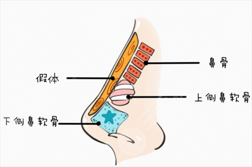 磨鼻骨10年后會怎么樣？磨鼻骨的手術(shù)果及注意事項有哪些？【今日科普】